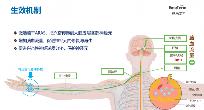 创新合作:正中神经电刺激手环对轻度阿尔茨海默病患者的疗效启动研究-消费日报网