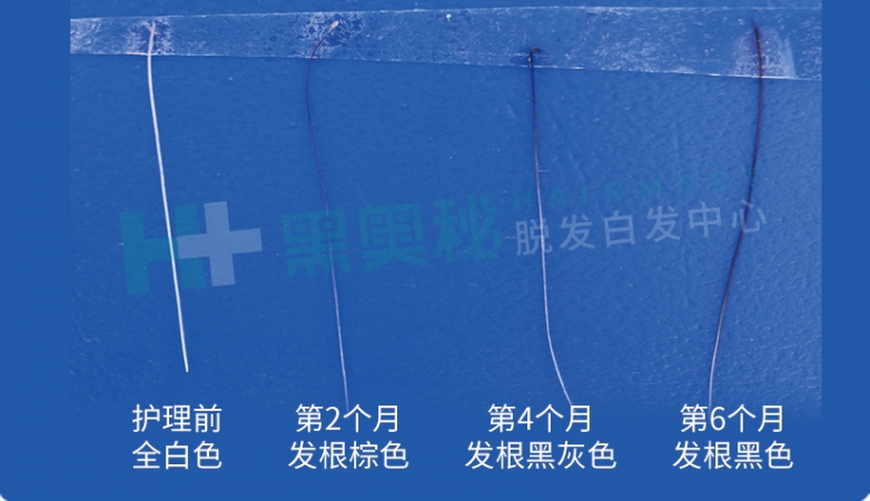 了不起的中国成分富勒烯!黑奥秘在脱发白发领域又遥遥领先了!