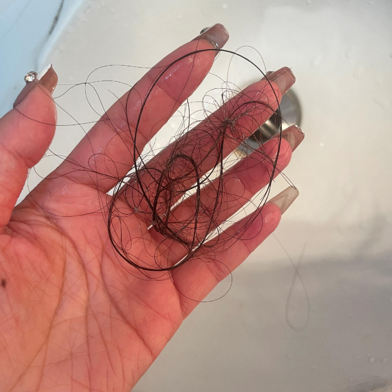 滋养健发洗发水什么牌子最有效果？详解前十名，弥漫性脱发、发根细软科学干预