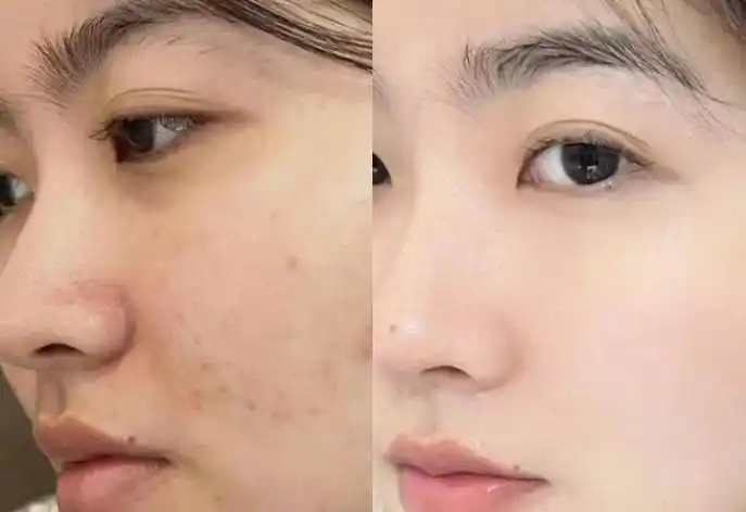 实测2026植物淡斑什么牌子护肤品好？最新植萃焕白护肤品盘点：天然亮肤护肤品推荐_https://www.izongheng.net_快讯_第4张