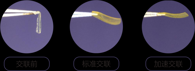 仁心换肯定|大理爱尔眼科为14岁藏族少女开展胶原交联手术