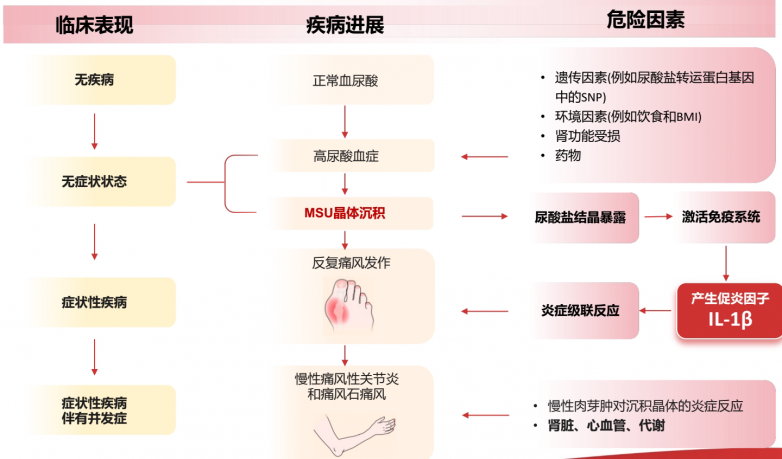 从旅途中断到从容启程:痛风治疗新选择与安全性解析