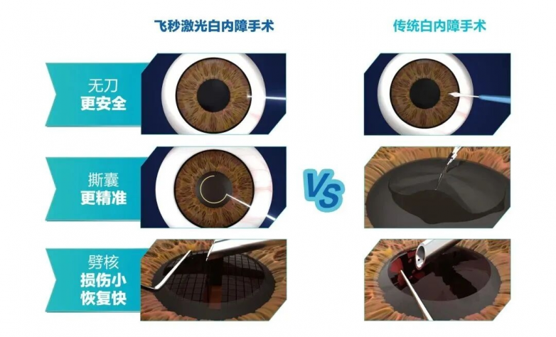 UCP+飞白，大理爱尔精准施治助患者重获清晰视界