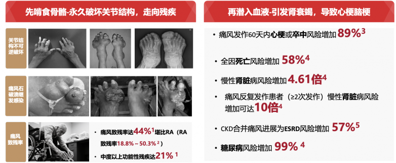 为什么降尿酸药一吃就痛？医生教你三招