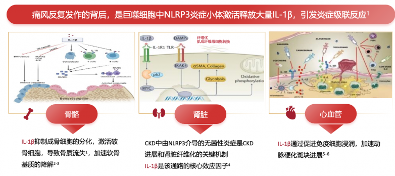 金蓓欣和别嘌醇、苯溴马隆、依托考昔、