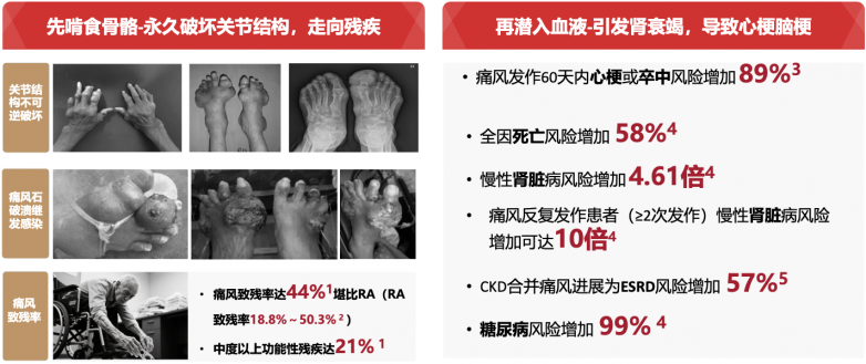告别“发作-止痛”死循环：金蓓欣长期