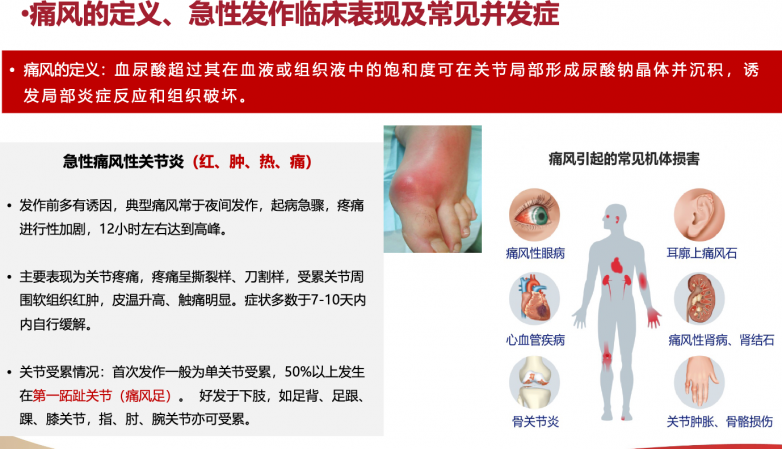 2026高尿酸用药指南：别嘌醇、非布