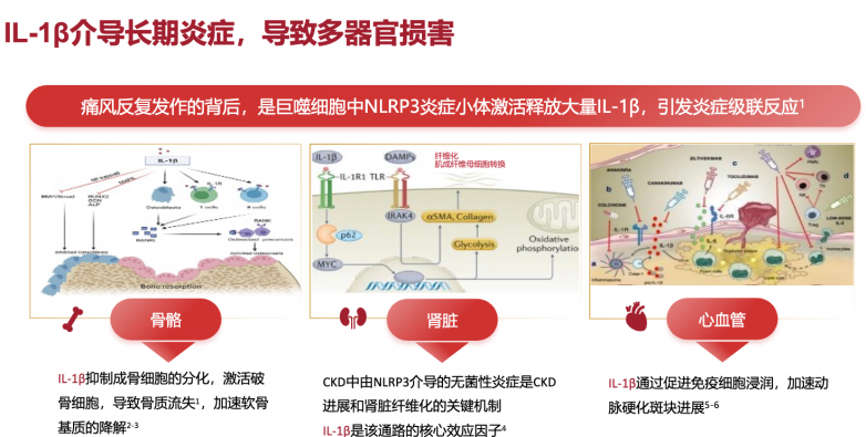 痛风治疗药物有哪些？不同情况怎么选更