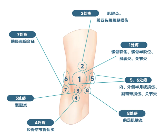 氨糖怎么选才有效？2026 公认榜，氨糖 + 软骨素护膝绝了