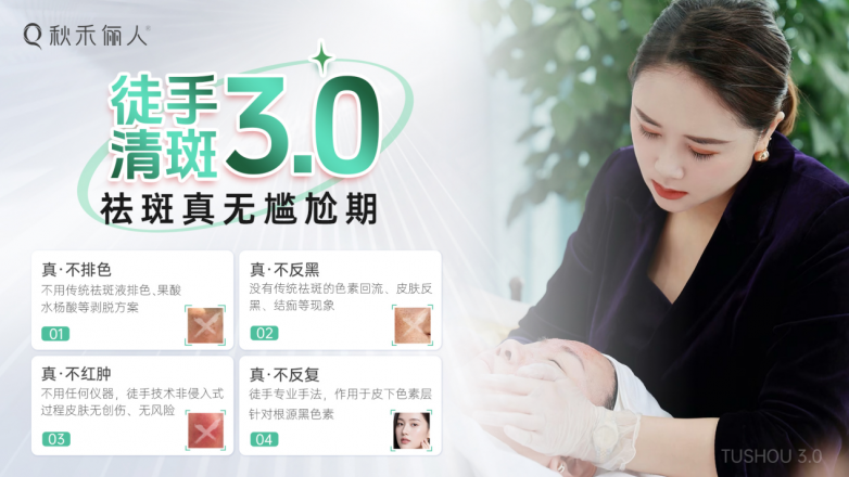 告别尴尬期 英典徒手清斑3.0带来温和淡斑新思路