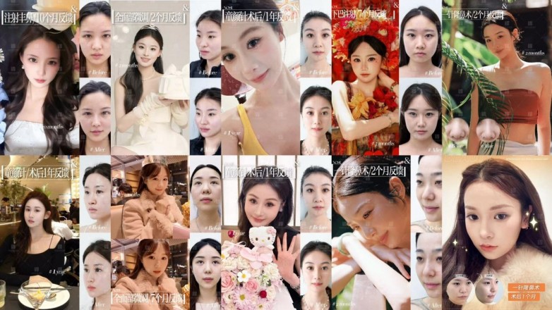 打爱贝芙,大家为什么都选择河南整形美容医院支凌翔技术院长(图10) 打爱贝芙,大家为什么都选择河南整形美容医院支凌翔技术院长(图10)