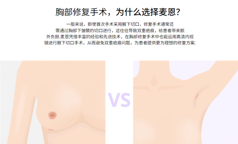 韩国麦恩隆胸修复：重建自信的一步
