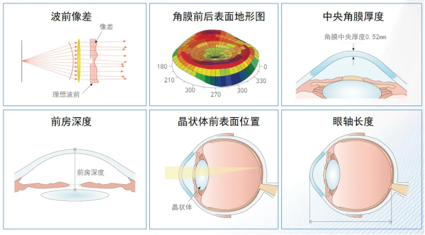 1分钟，南昌爱尔卢恒松院长带你快速了解“3D精雕（全光塑）”近视手术…