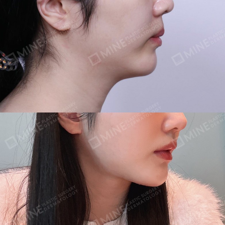 debe05c3f834d284b456fed9eaf25d4.jpg