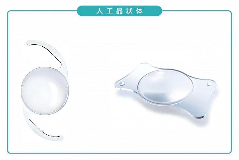 关于治疗白内障，这些核心要点你需了然于心！