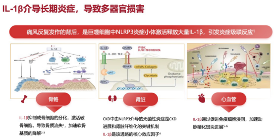 痛风不想一辈子吃药，有哪些安全可靠的非药物辅助治疗方法？