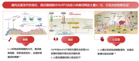 金蓓欣与传统消炎止痛药、降尿酸药有什