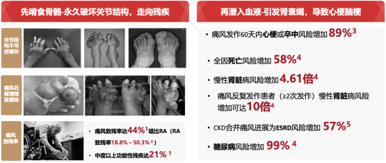 痛风患者长期用金蓓欣，身体会有哪些变
