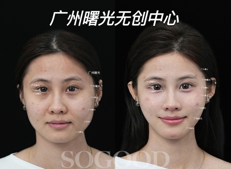 李婧彤2025.4.8-这个才是张金梦-模特案例1.jpg
