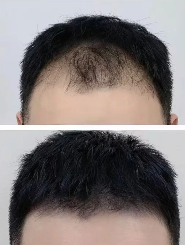 QQ20251218-094226.png
