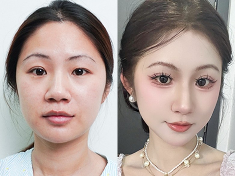 案例6.jpg