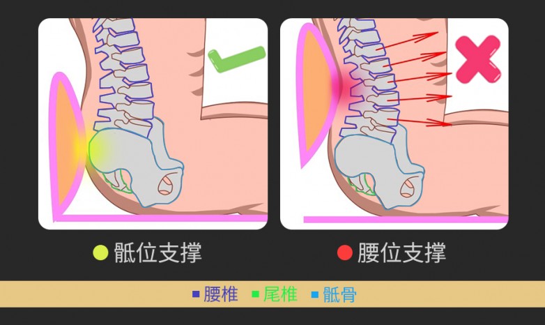 骶位支撑.jpg