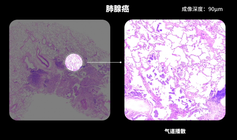 肺.png