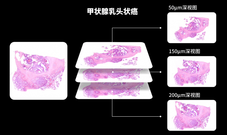 甲状腺.png